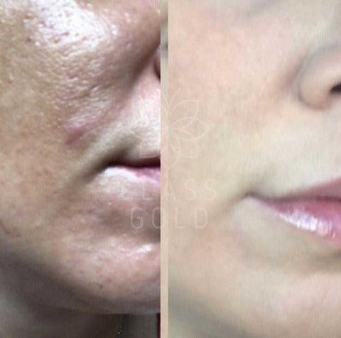 JABÓN FACIAL CLASS GOLD ANTIOXIDANTE PIEL GRASA 32GRS