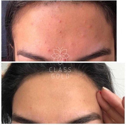 JABÓN FACIAL CLASS GOLD ANTIOXIDANTE PIEL MIXTA A SECA 32GRS
