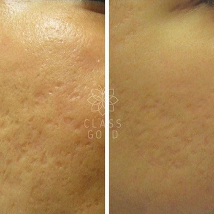 JABÓN FACIAL CLASS GOLD ANTIOXIDANTE PIEL GRASA 32GRS